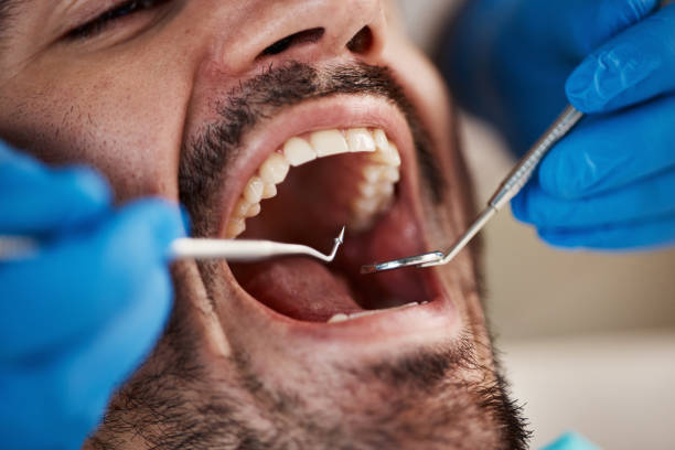 Best Knocked-Out Tooth Emergency  in Liberty Lake, WA