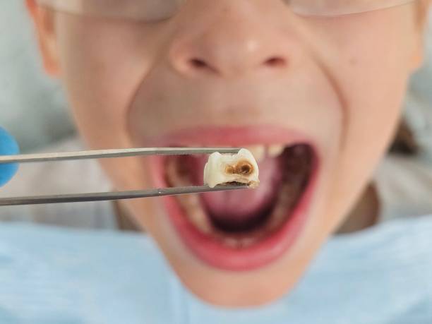 Best Tooth Infection Emergency Dentist  in Liberty Lake, WA