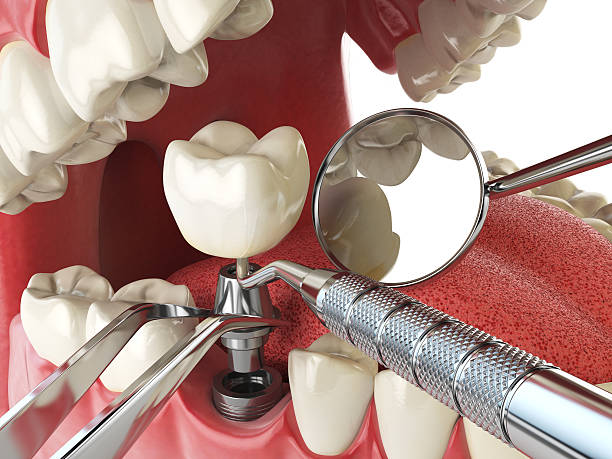 Best Dentist for Severe Toothache  in Liberty Lake, WA
